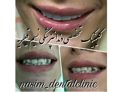 پروتز های ثابت و متحرک-دندانپزشکی در منطقه یک تهران ،  کلینیک دندانپزشکی نسیم قیطریه