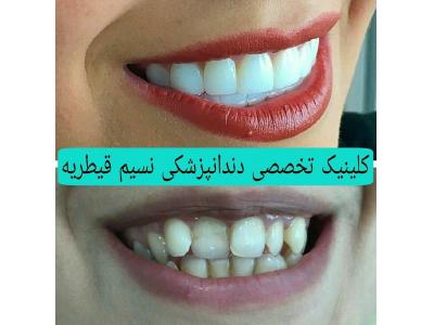 دندانپزشکی در منطقه تهران-دندانپزشکی در منطقه یک تهران ،  کلینیک دندانپزشکی نسیم قیطریه