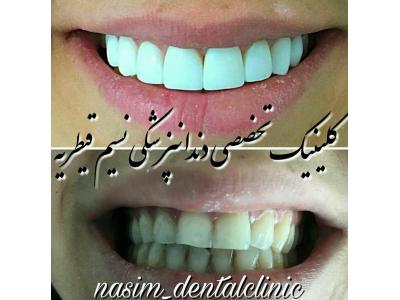جراحی زیبایی صورت-دندانپزشکی در منطقه یک تهران ،  کلینیک دندانپزشکی نسیم قیطریه