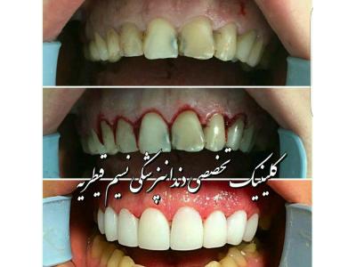 سیم کشی-دندانپزشکی در منطقه یک تهران ،  کلینیک دندانپزشکی نسیم قیطریه