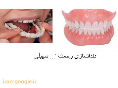 پروتز های ثابت و متحرک-دندانسازی رحمت اله سهیلی ساخت پروتز ثابت و متحرک